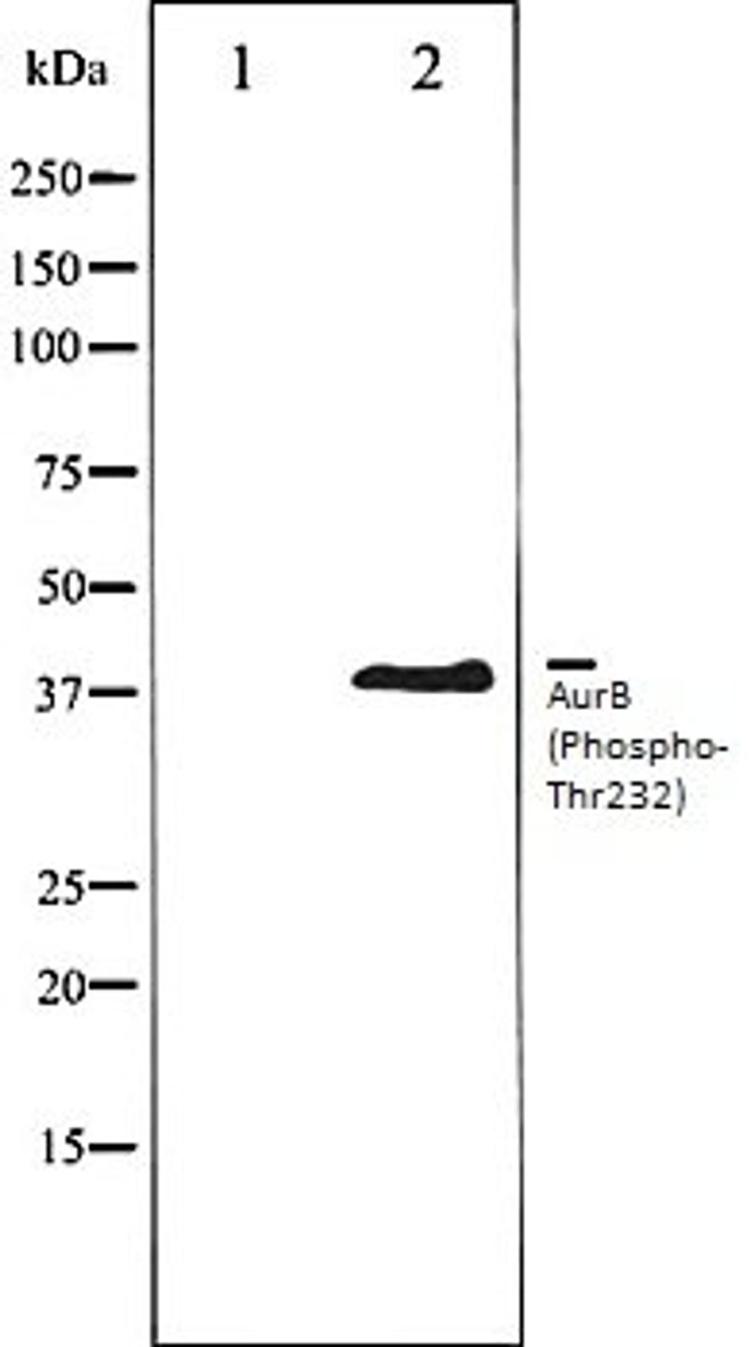 Western blot analysis of COS7 whole cell lysates using AurB (Phospho-Thr232) antibody, The lane on the left is treated with the antigen-specific peptide.