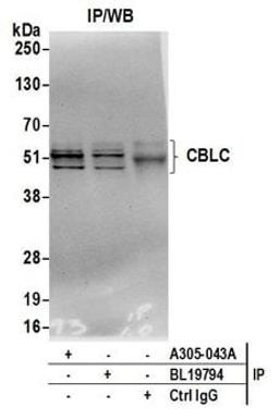 Detection of human CBLC by western blot of immunoprecipitates.