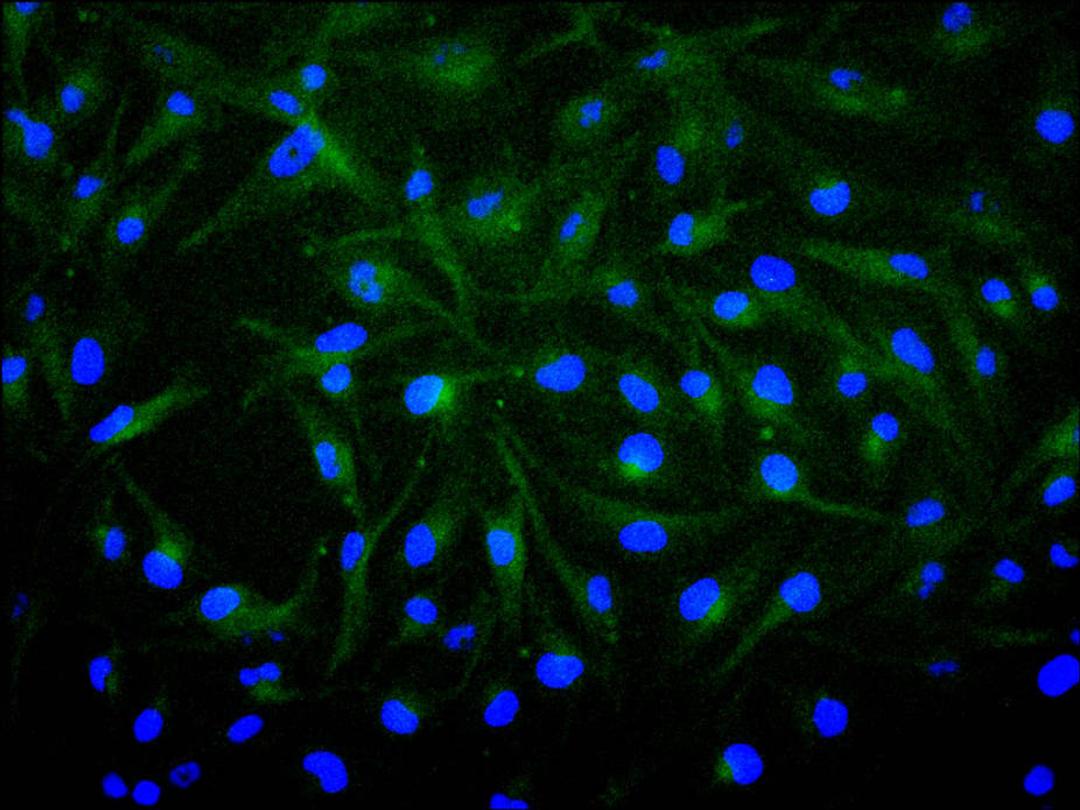 Immunofluorescence staining of U251 cell with CSB-RA008615MA1HU at 1:200, counter-stained with DAPI. The cells were fixed in 4% formaldehyde and blocked in 10% normal Goat Serum. The cells were then incubated with the antibody overnight at 4C. The secondary antibody was FITC-conjugated AffiniPure Goat Anti-Mouse IgG(H+L).