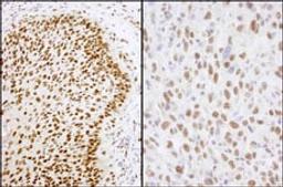 Detection of human and mouse Matrin 3 by immunohistochemistry.