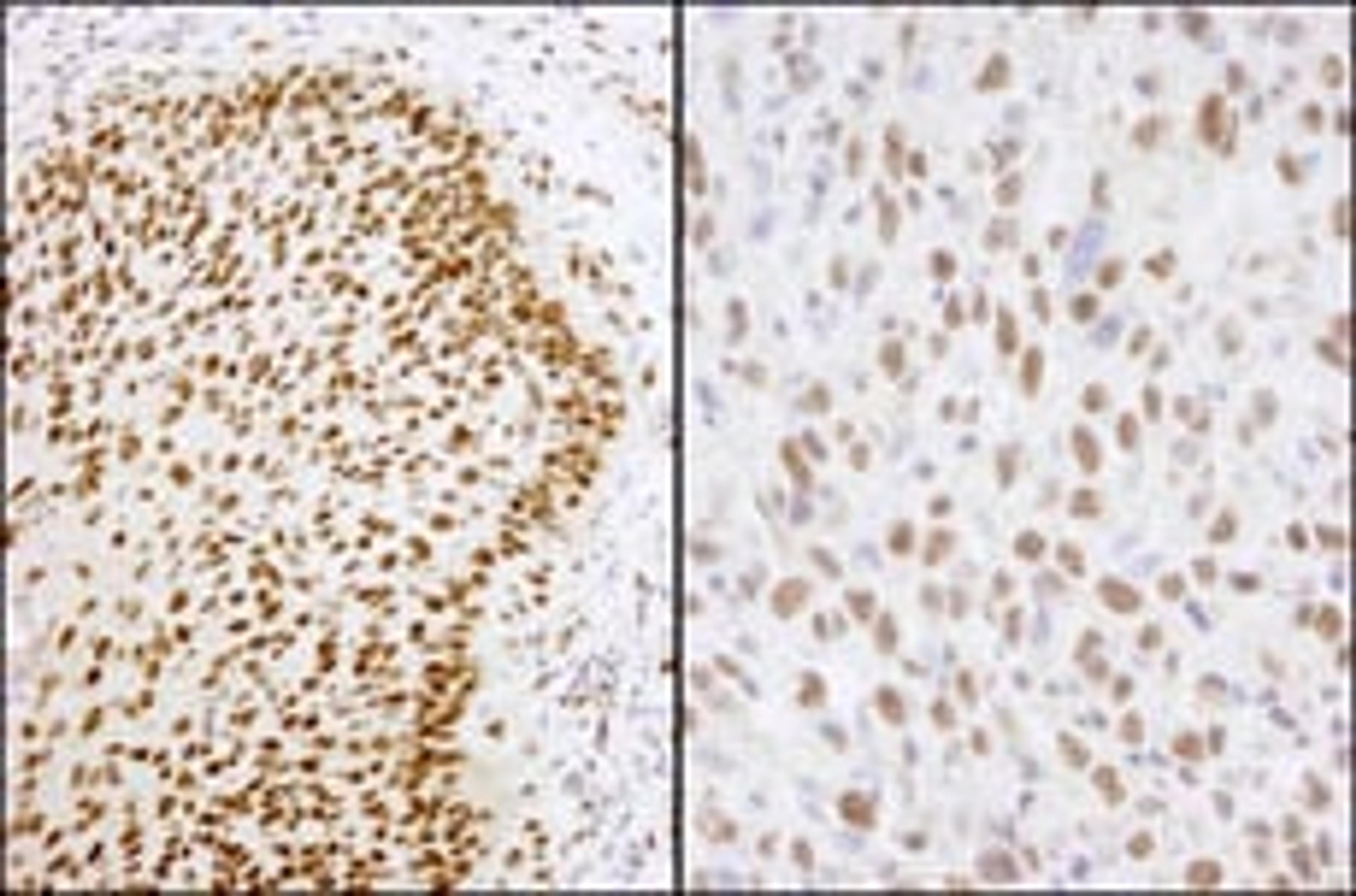 Detection of human and mouse Matrin 3 by immunohistochemistry.