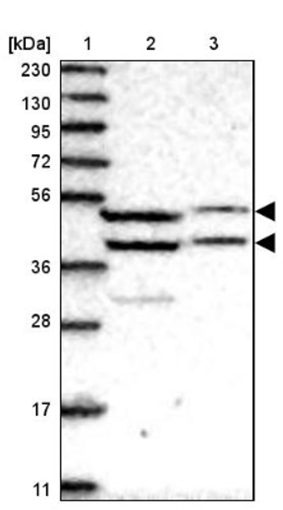 Western Blot: RG9MTD1 Antibody [NBP1-83654] - Lane 1: Marker [kDa] 230, 130, 95, 72, 56, 36, 28, 17, 11<br/>Lane 2: Human cell line RT-4<br/>Lane 3: Human cell line U-251MG sp