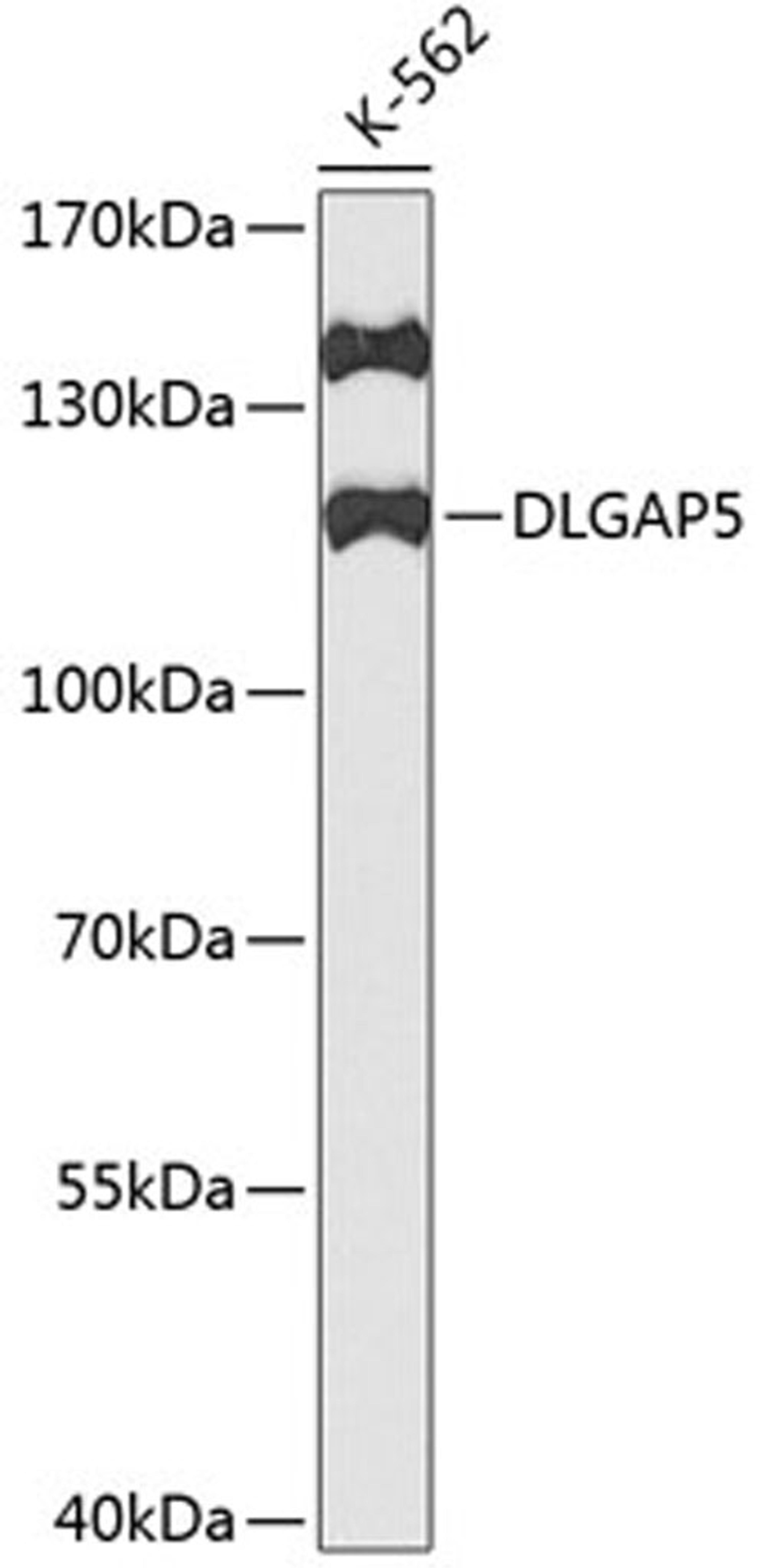 Western blot - DLGAP5 antibody (A2197)