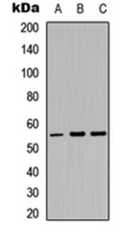 Western blot analysis of HepG2 (Lane 1), K562 (Lane 2), NIH3T3 (Lane 3) whole cell lysates using MYT1 antibody