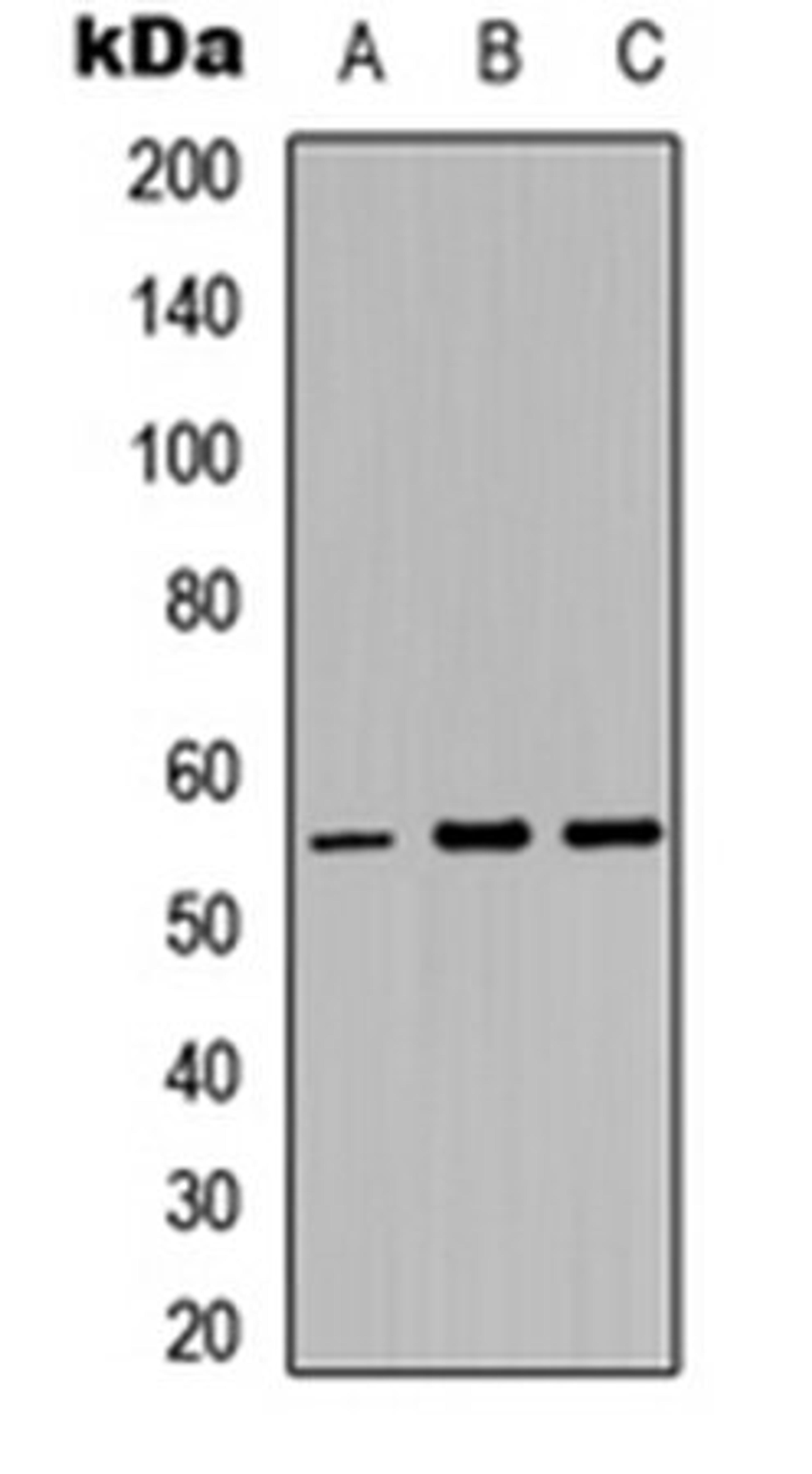 Western blot analysis of HepG2 (Lane 1), K562 (Lane 2), NIH3T3 (Lane 3) whole cell lysates using MYT1 antibody