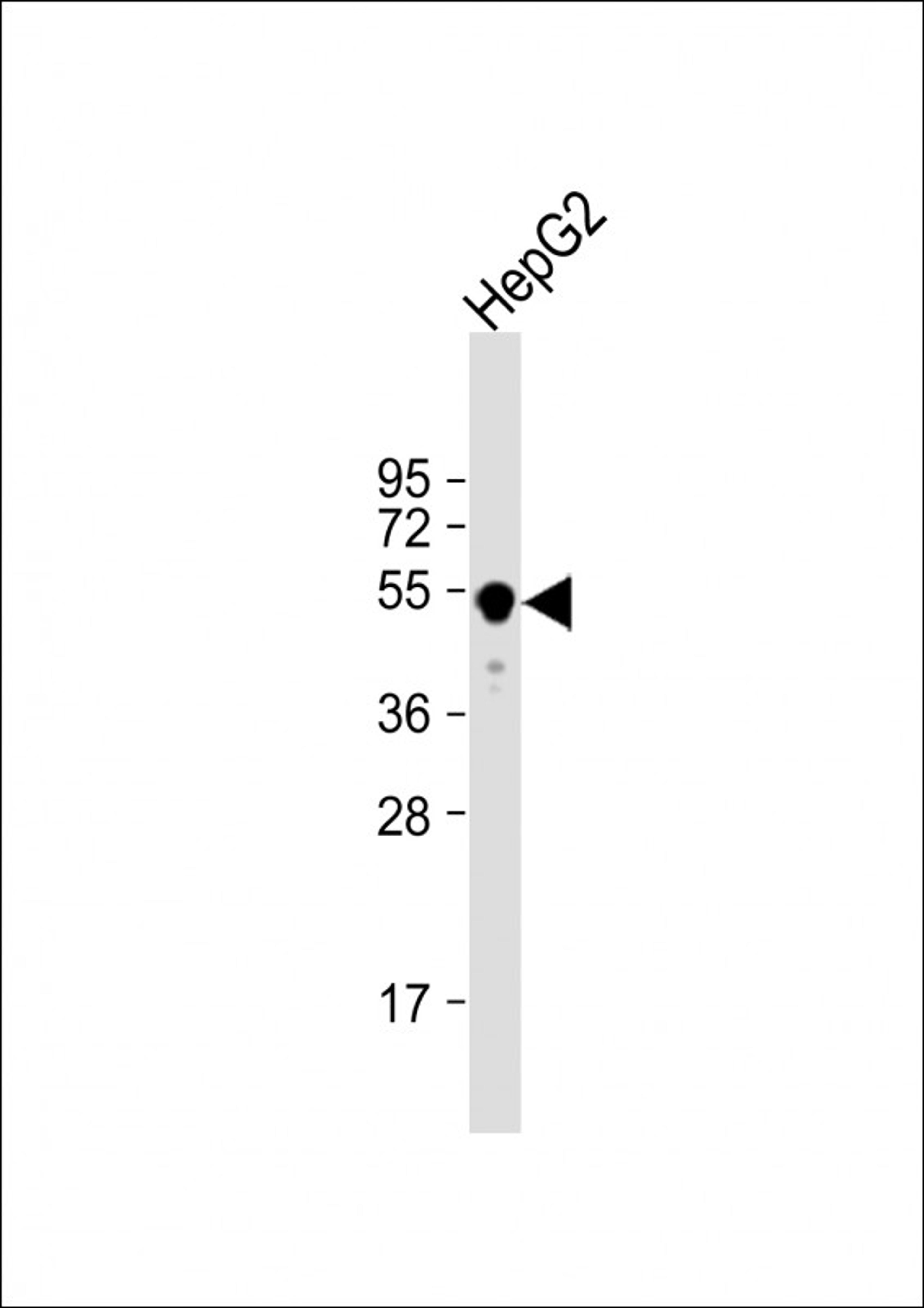 Western Blot at 1:1000 dilution + HepG2 whole cell lysate Lysates/proteins at 20 ug per lane.