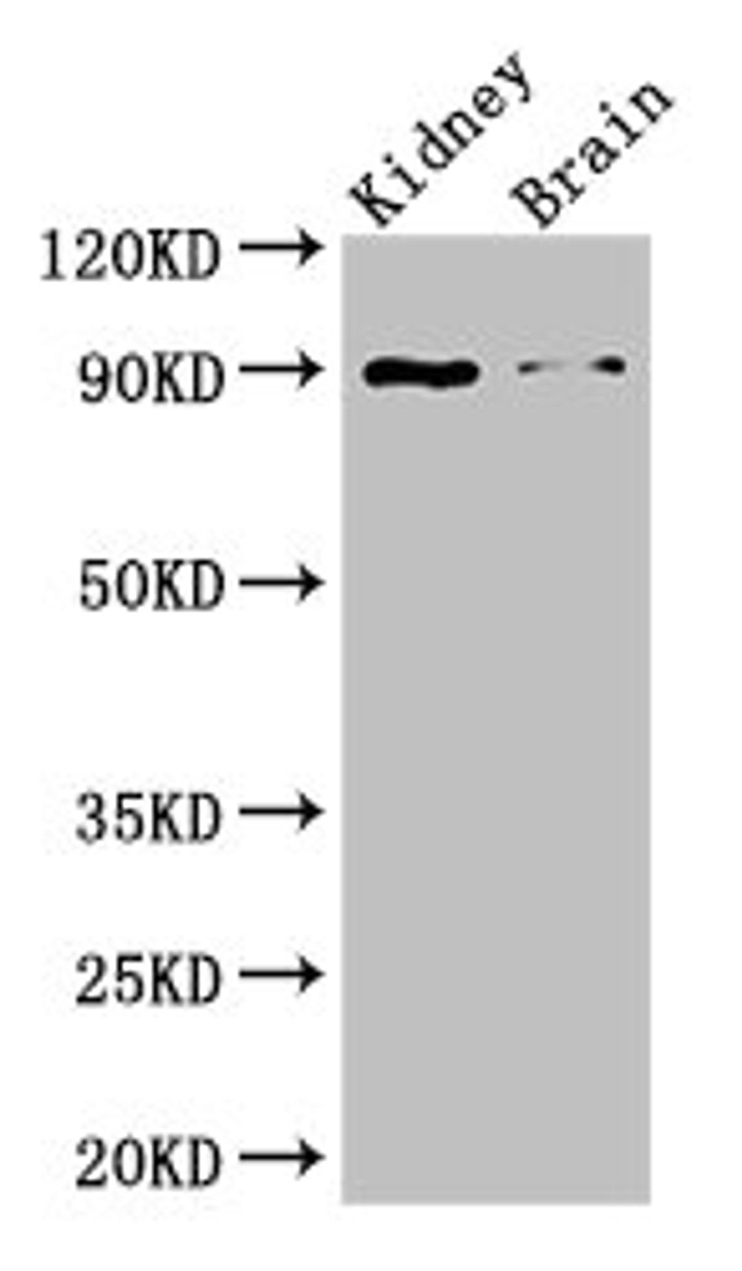 Western Blot. Positive WB detected in: Mouse kidney tissue, Mouse brain tissue. All lanes: IL4 antibody at 3ug/ml. Secondary. Goat polyclonal to rabbit IgG at 1/50000 dilution. Predicted band size: 18, 16 kDa. Observed band size: 90 kDa. 