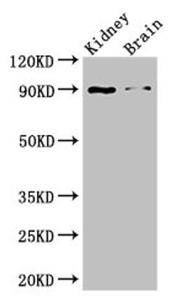 Western Blot. Positive WB detected in: Mouse kidney tissue, Mouse brain tissue. All lanes: IL4 antibody at 3ug/ml. Secondary. Goat polyclonal to rabbit IgG at 1/50000 dilution. Predicted band size: 18, 16 kDa. Observed band size: 90 kDa. 