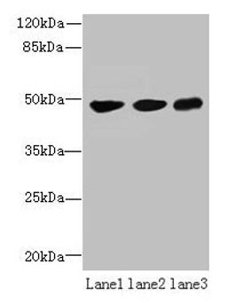 Western blot. All lanes: UXS1 antibody at 6µg/ml. Lane 1: Mouse lung tissue. Lane 2: Jurkat whole cell lysate. Lane 3: HepG2 whole cell lysate. Secondary. Goat polyclonal to rabbit IgG at 1/10000 dilution. Predicted band size: 48, 49, 29 kDa. Observed band size: 48 kDa