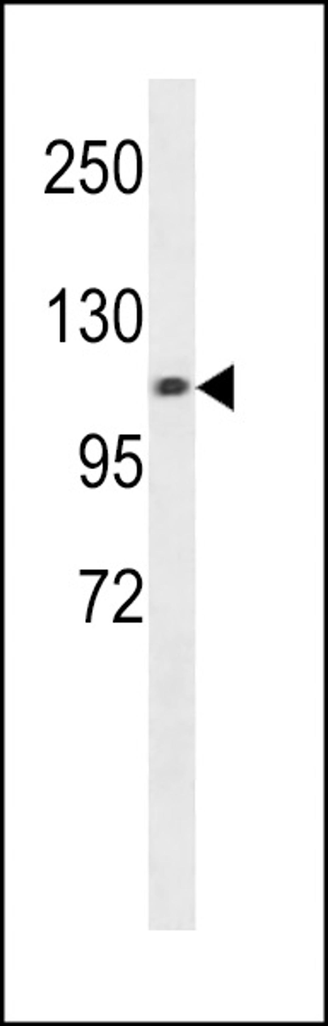 Western blot analysis in A549 cell line lysates (35ug/lane).