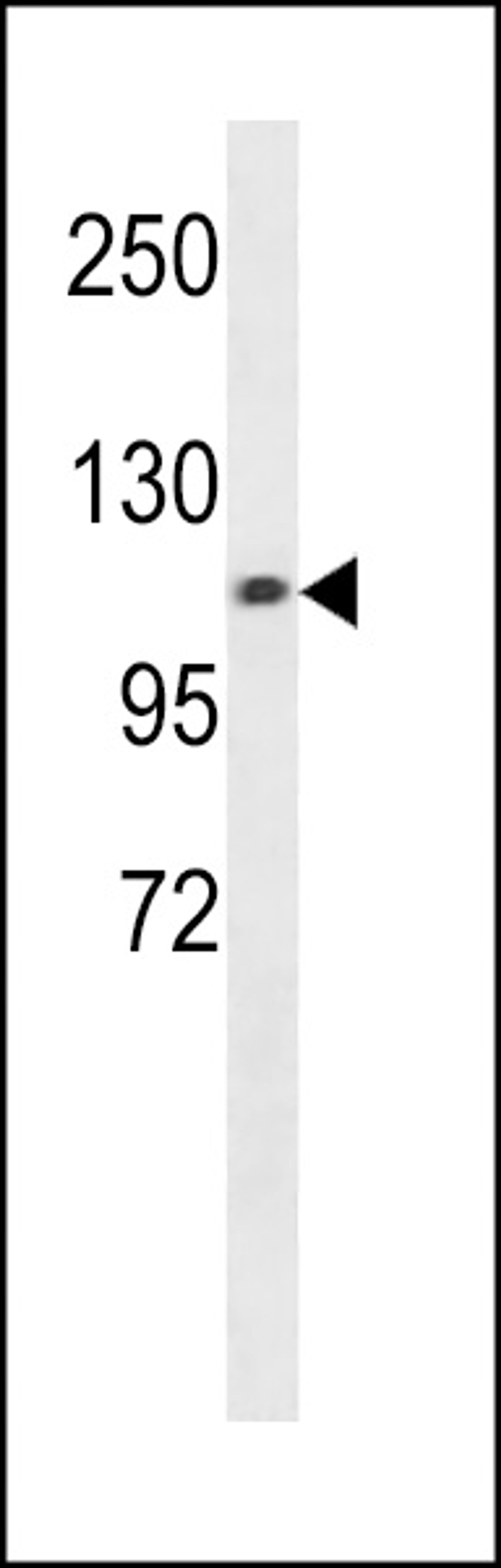 Western blot analysis in A549 cell line lysates (35ug/lane).