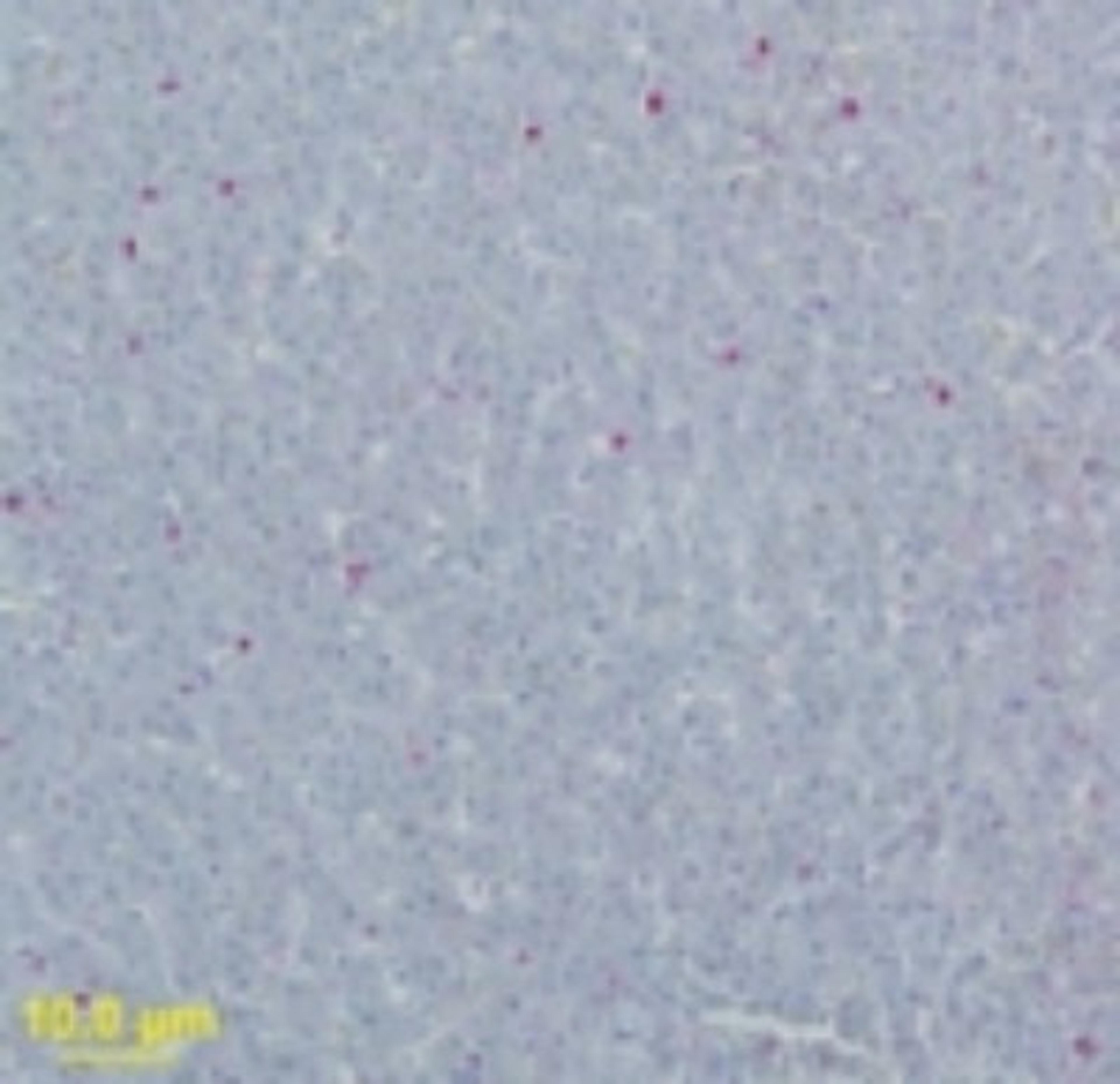 Immunohistochemistry-Paraffin: WNVM Antibody [NB100-56743] - analysis of WNV-Envelope protein in bird liver using this antibody at 1 ug/ml, incubated for 30 minutes. A Ventana brand second step antibody conjugated to biotin was applied followed with streptavidin-AKP. The substrate was Fast Red chromagen. The antigen retrieval method used to obtain staining: Ventana Protease 2 for three minutes at room temperature with a Parafilm coverslip. (using an autostainer which keeps residual fluid on the slides during every step, so the final concentration is approximately 2.5 times more dilute). Image and protocol used to generate this image are courtesy of Angela Ellis, University of Georgia College of Veterinary Medicine.