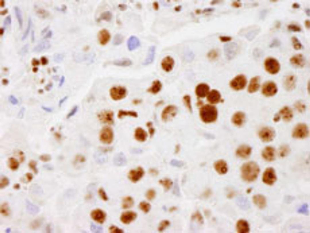 Detection of human PELP1/MNAR by immunohistochemistry.