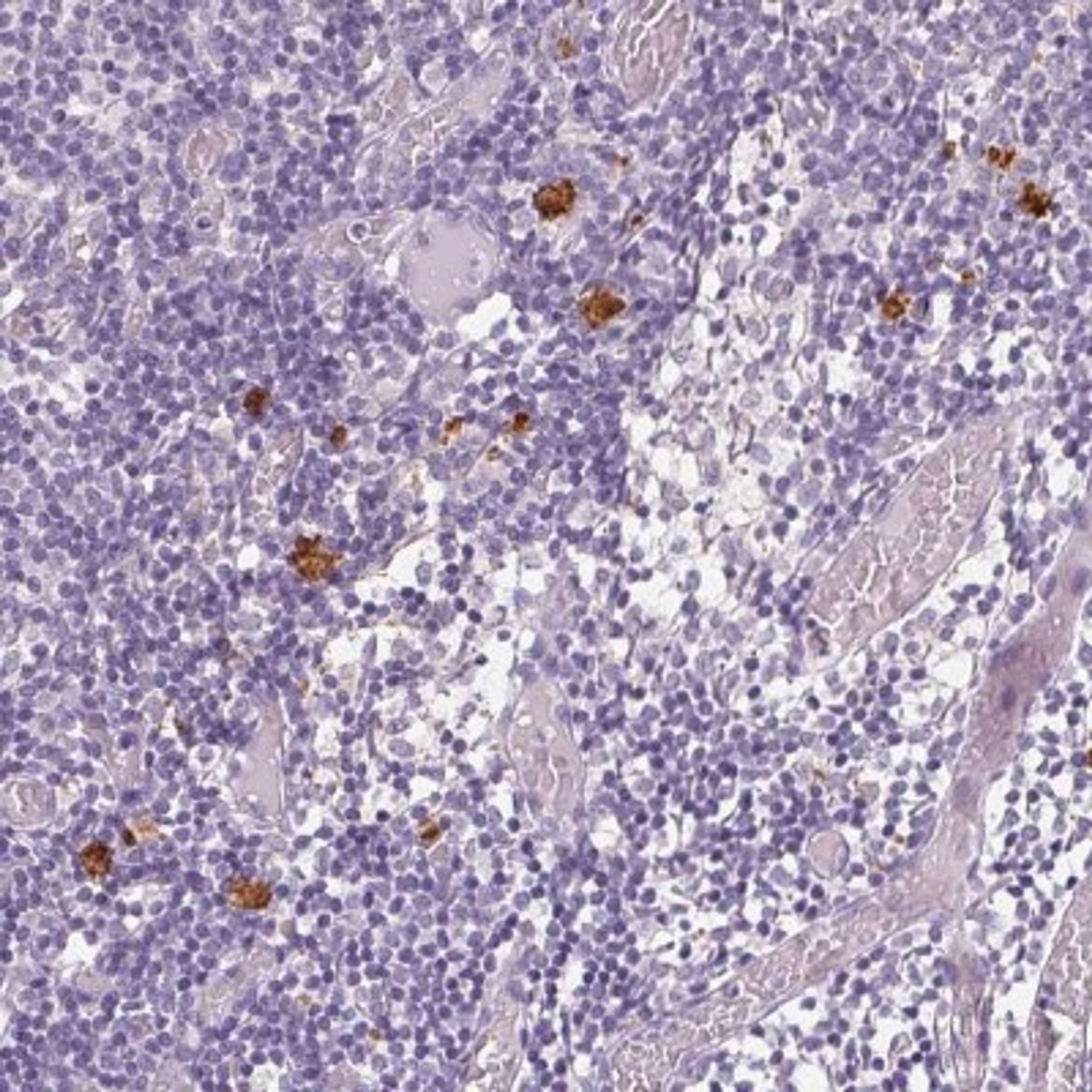 Immunohistochemistry: CXCL5 Antibody [NBP2-39058] - Staining of human lymph node shows strong cytoplasmic positivity in non-germinal center cells.