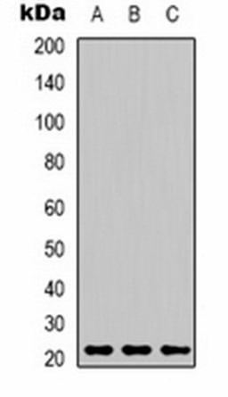 Western blot analysis of MCF7 (Lane 1), mouse brain (Lane 2), rat kidney (Lane 3) whole cell lysates using Peroxiredoxin 1 antibody