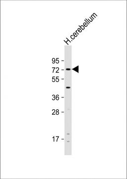 Western Blot at 1:1000 dilution + human cerebellum lysate Lysates/proteins at 20 ug per lane.