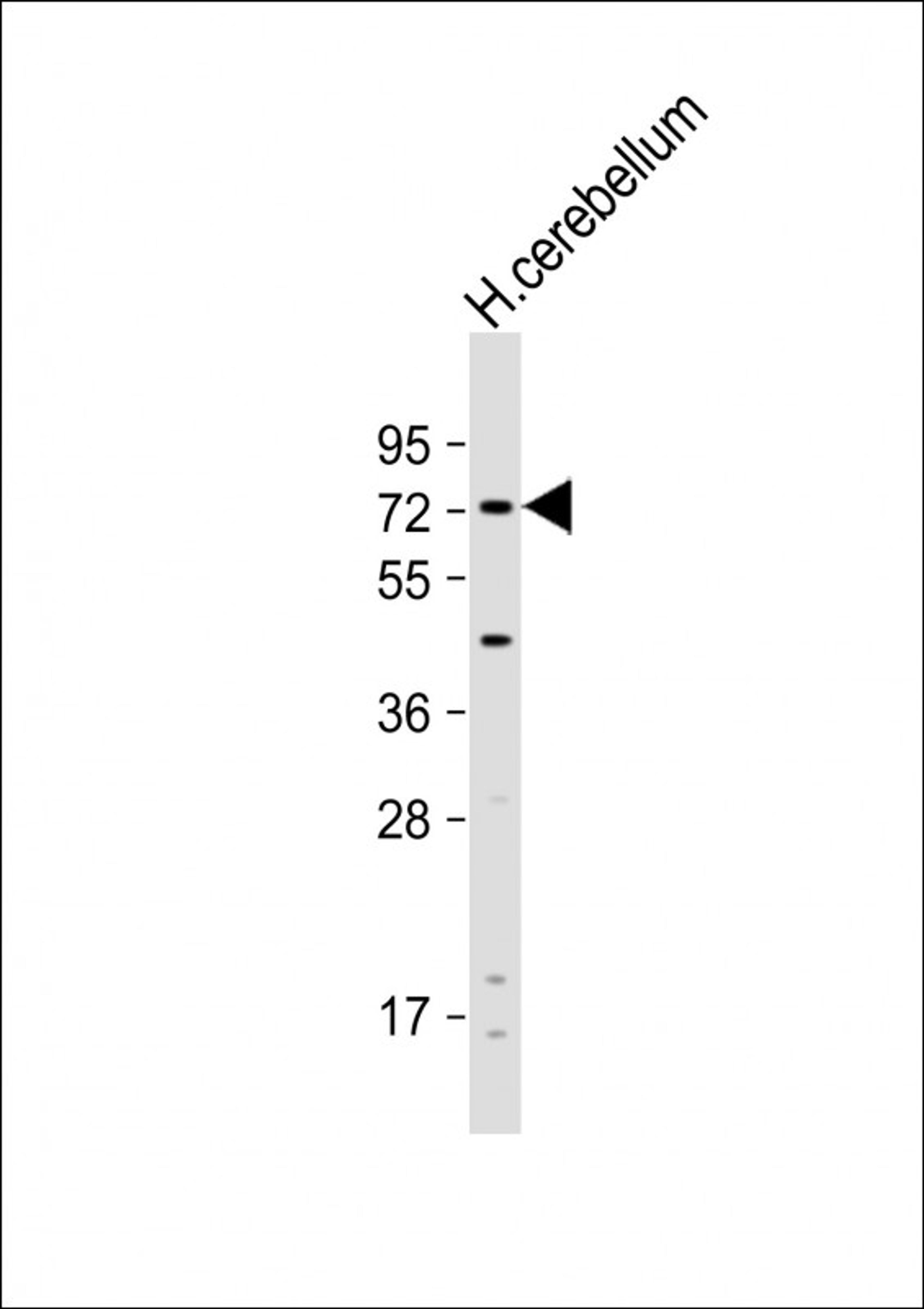 Western Blot at 1:1000 dilution + human cerebellum lysate Lysates/proteins at 20 ug per lane.