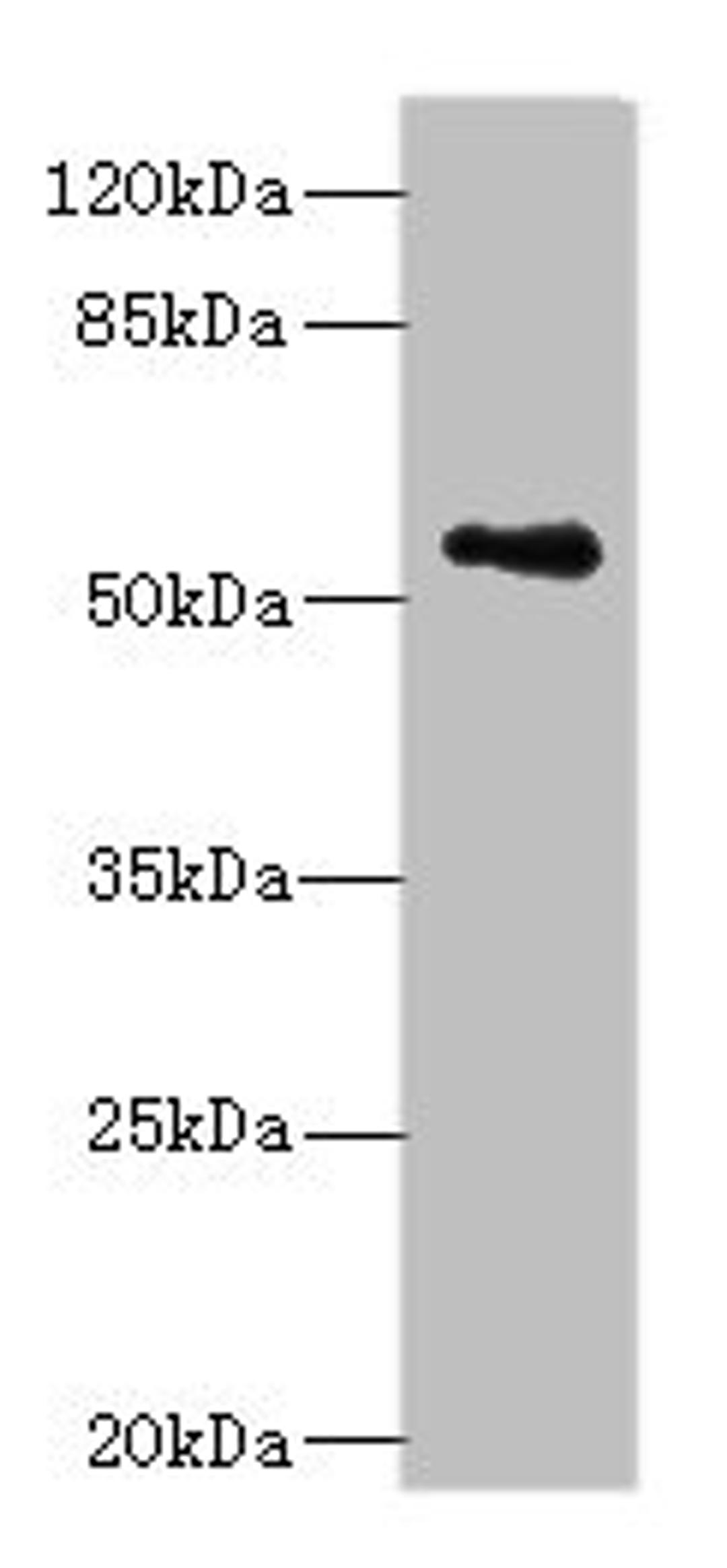 Western blot. All lanes: ZSCAN32 antibody at 1µg/ml + MCF-7 whole cell lysate. Secondary. Goat polyclonal to rabbit IgG at 1/10000 dilution. Predicted band size: 79, 55, 47 kDa. Observed band size: 55 kDa