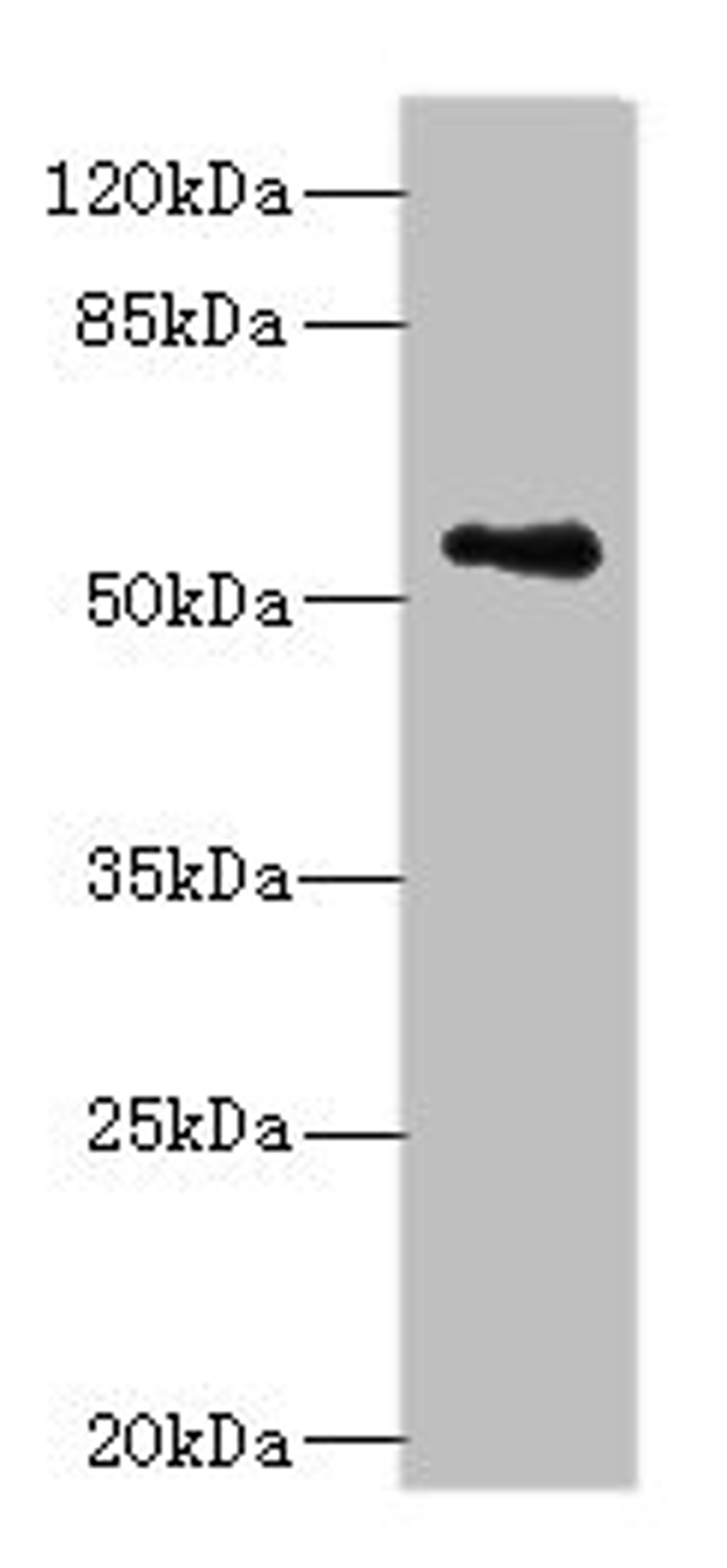 Western blot. All lanes: ZSCAN32 antibody at 1µg/ml + MCF-7 whole cell lysate. Secondary. Goat polyclonal to rabbit IgG at 1/10000 dilution. Predicted band size: 79, 55, 47 kDa. Observed band size: 55 kDa