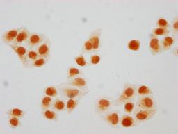 Immunocytochemistry analysis of CSB-PA010403PA108hibHU diluted at 1:20 and staining in Hela cells(treated with 30mM sodium butyrate for 4h) performed on a Leica BondTM system. The cells were fixed in 4% formaldehyde, permeabilized using 0.2% Triton X-100 and blocked with 10% normal goat serum 30min at RT. Then primary antibody (1% BSA) was incubated at 4°C overnight. The primary is detected by a biotinylated secondary antibody and visualized using an HRP conjugated SP system.
