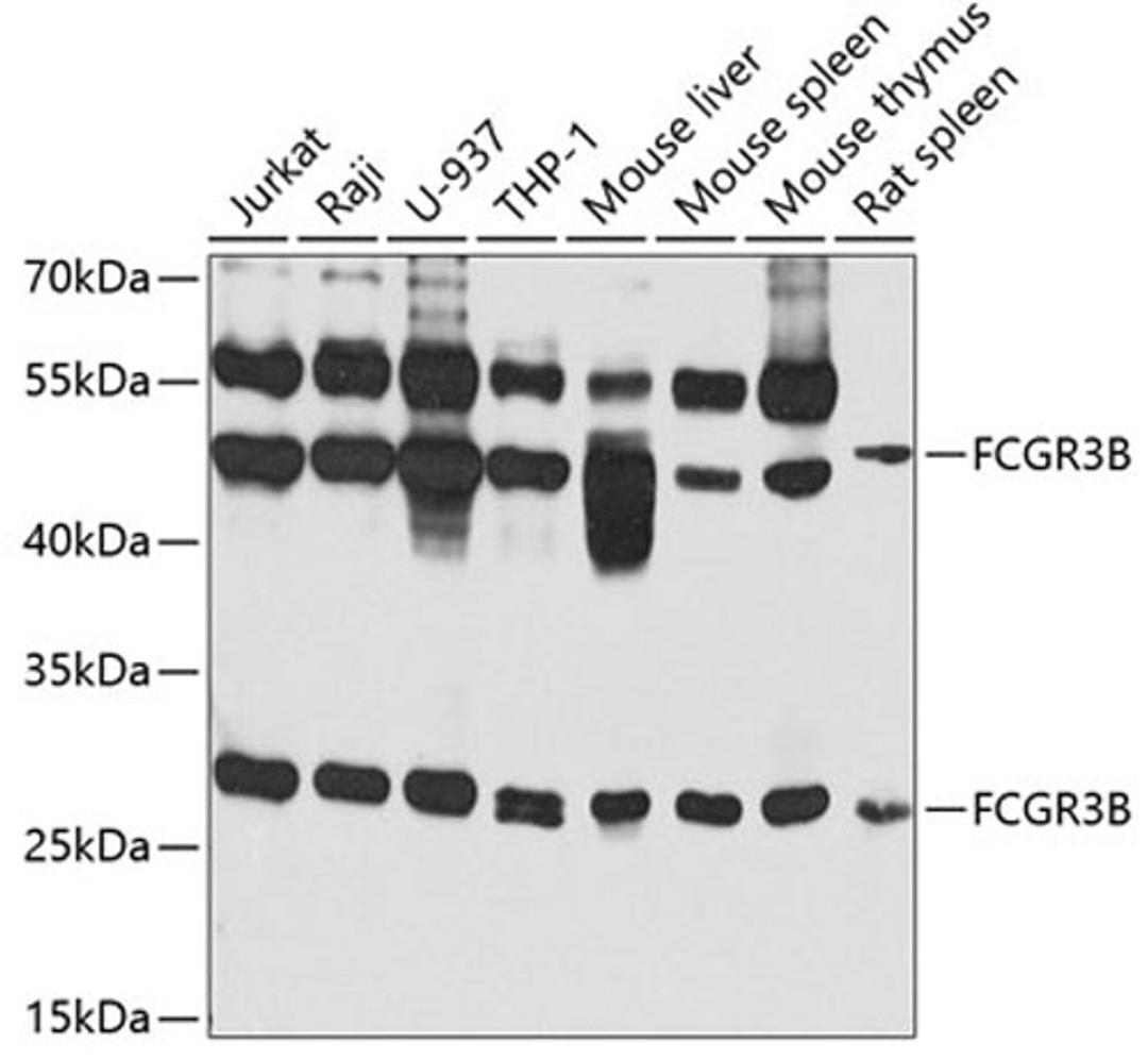 Western blot - FCGR3B antibody (A7894)