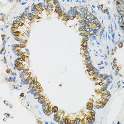 Immunohistochemistry  - PI3 antibody (A12482)