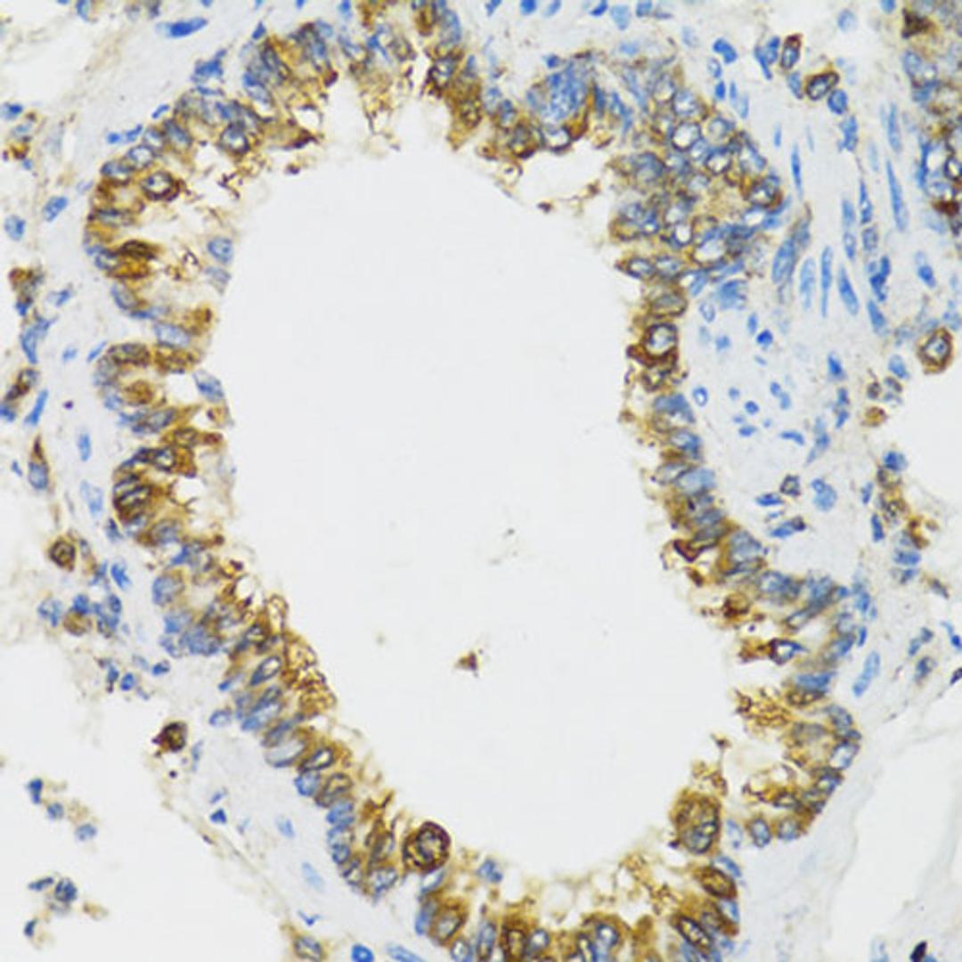 Immunohistochemistry - PI3 antibody (A12482)
