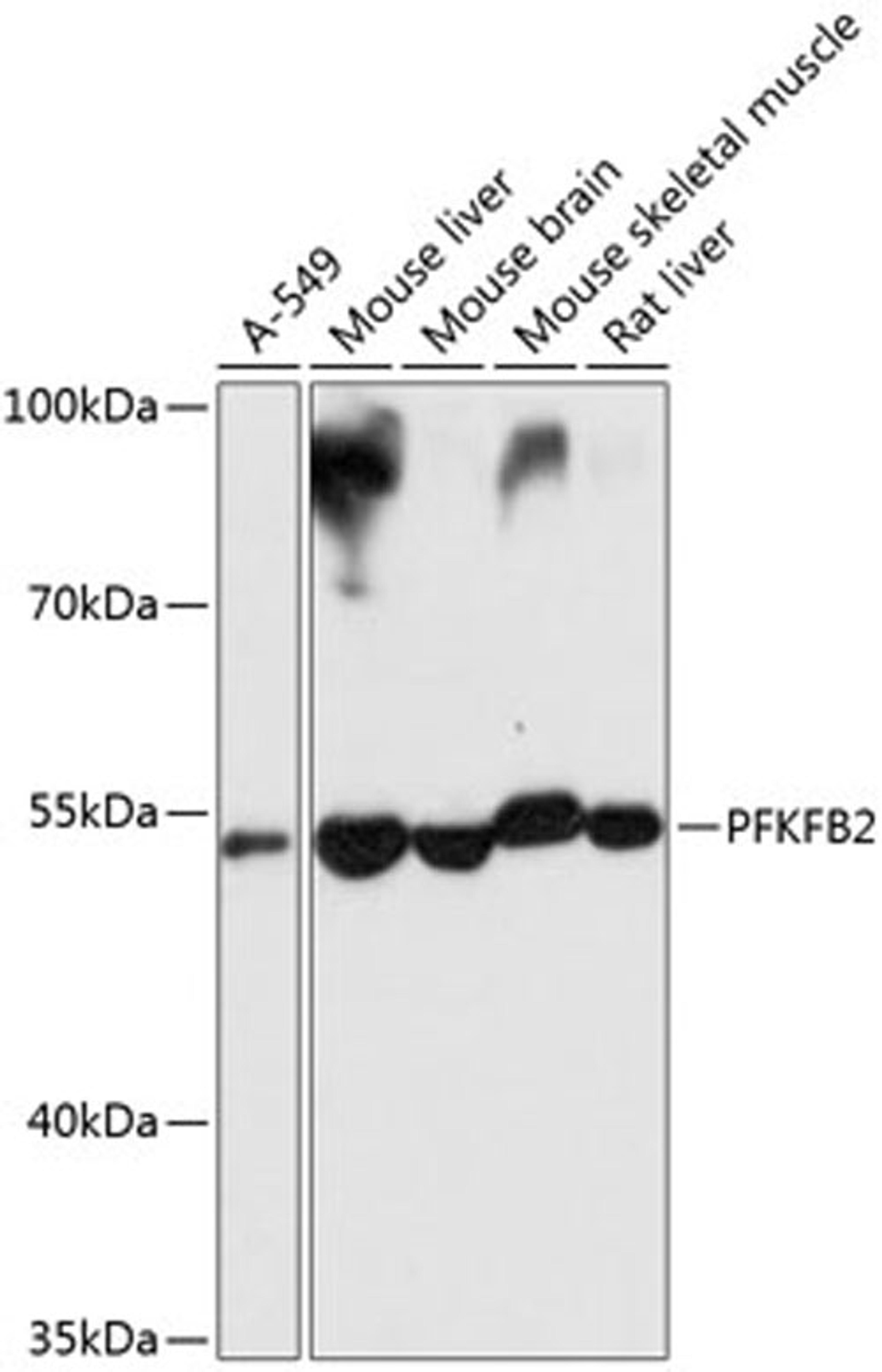 Western blot - PFKFB2 antibody (A9311)