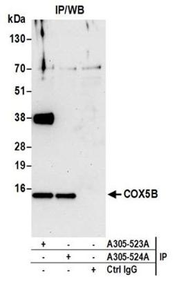 Detection of human COX5B by western blot of immunoprecipitates.