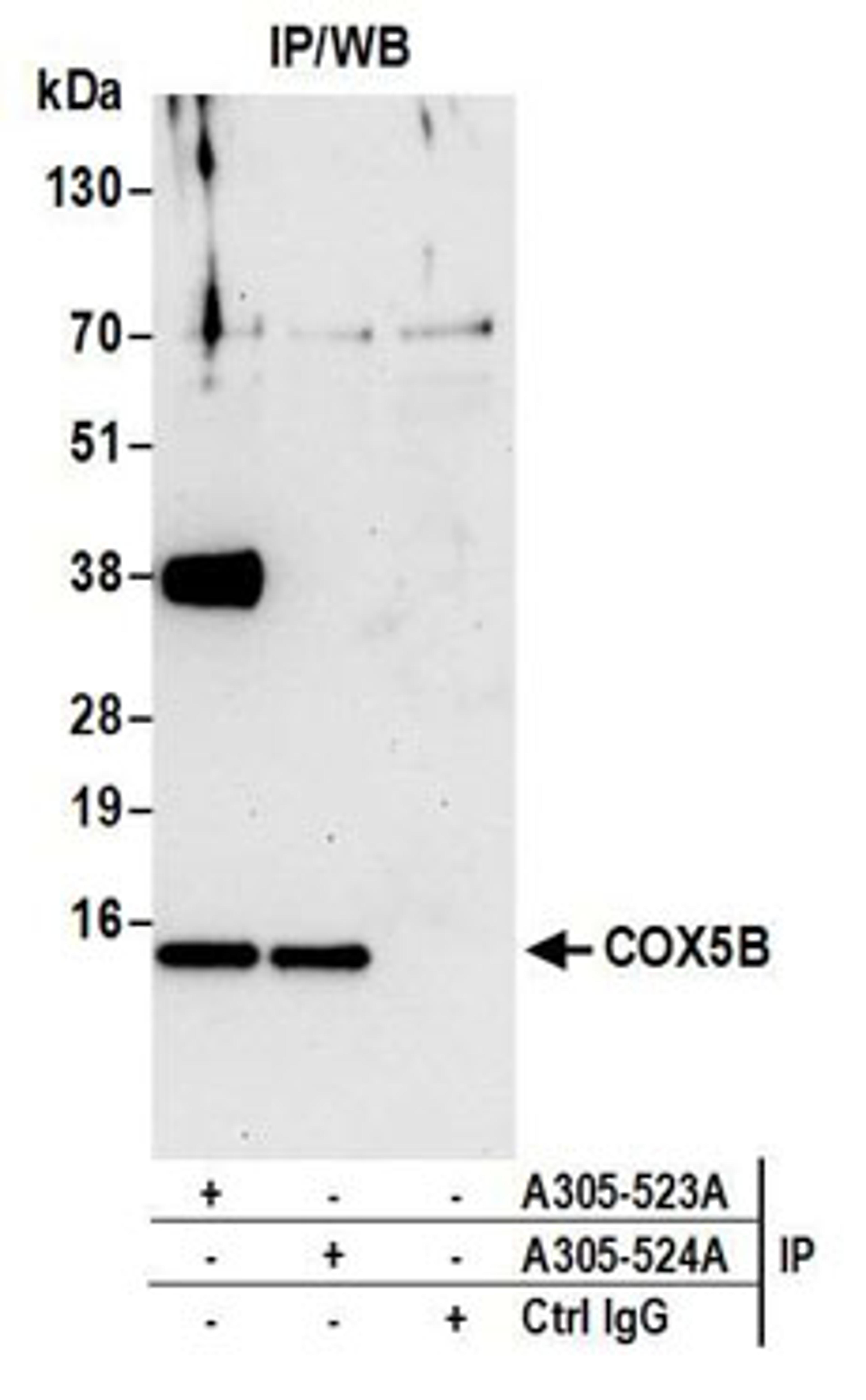 Detection of human COX5B by western blot of immunoprecipitates.