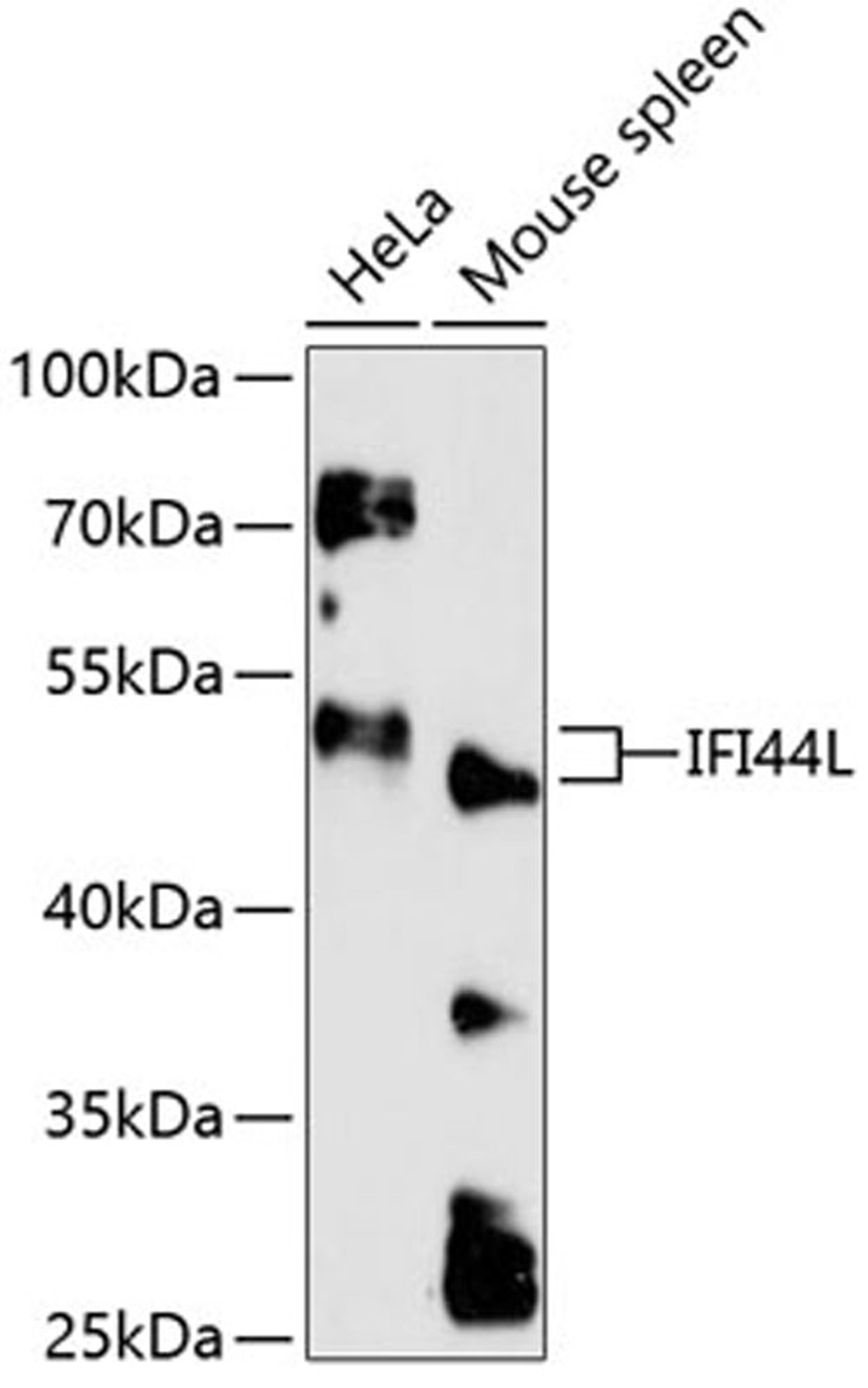 Western blot - IFI44L antibody (A13210)