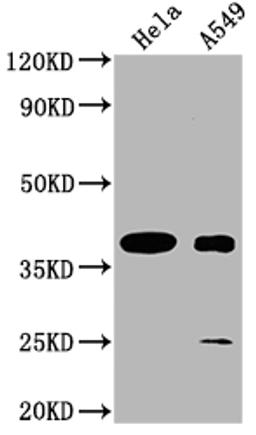 Western Blot. Positive WB detected in: Hela whole cell lysate, A549 whole cell lysate. All lanes: TAS2R7 antibody at 1:2000. Secondary. Goat polyclonal to rabbit IgG at 1/50000 dilution. Predicted band size: 37 kDa. Observed band size: 37 kDa. 
