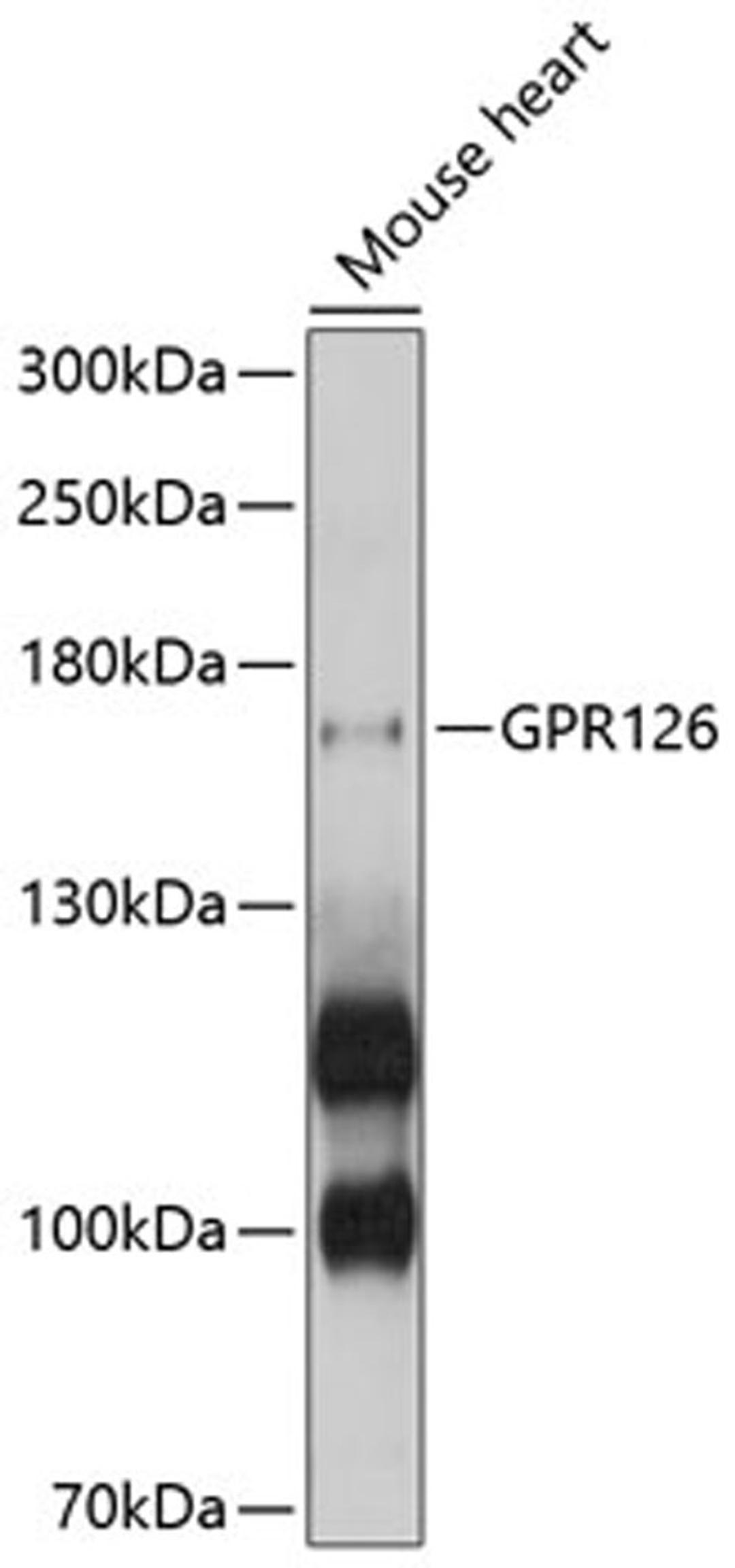 Western blot - GPR126 antibody (A10318)