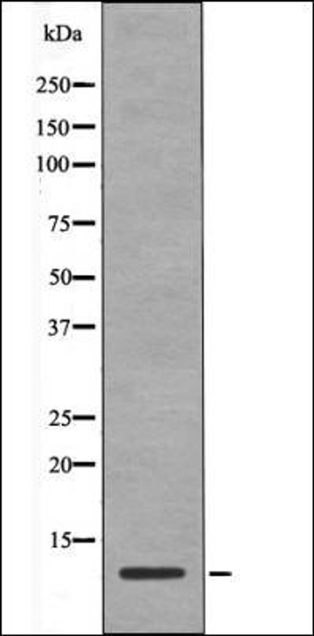 Western blot analysis of EGF treated NIH-3T3 whole cell lysates using HMG17 -Phospho-Ser29- antibody