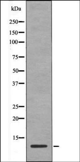 Western blot analysis of EGF treated NIH-3T3 whole cell lysates using HMG17 -Phospho-Ser29- antibody