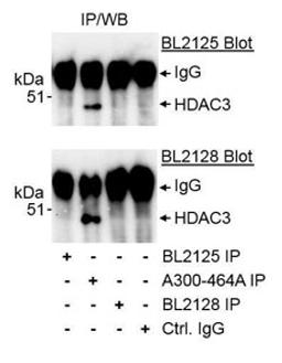 Detection of human HDAC3 by western blot of immunoprecipitates.