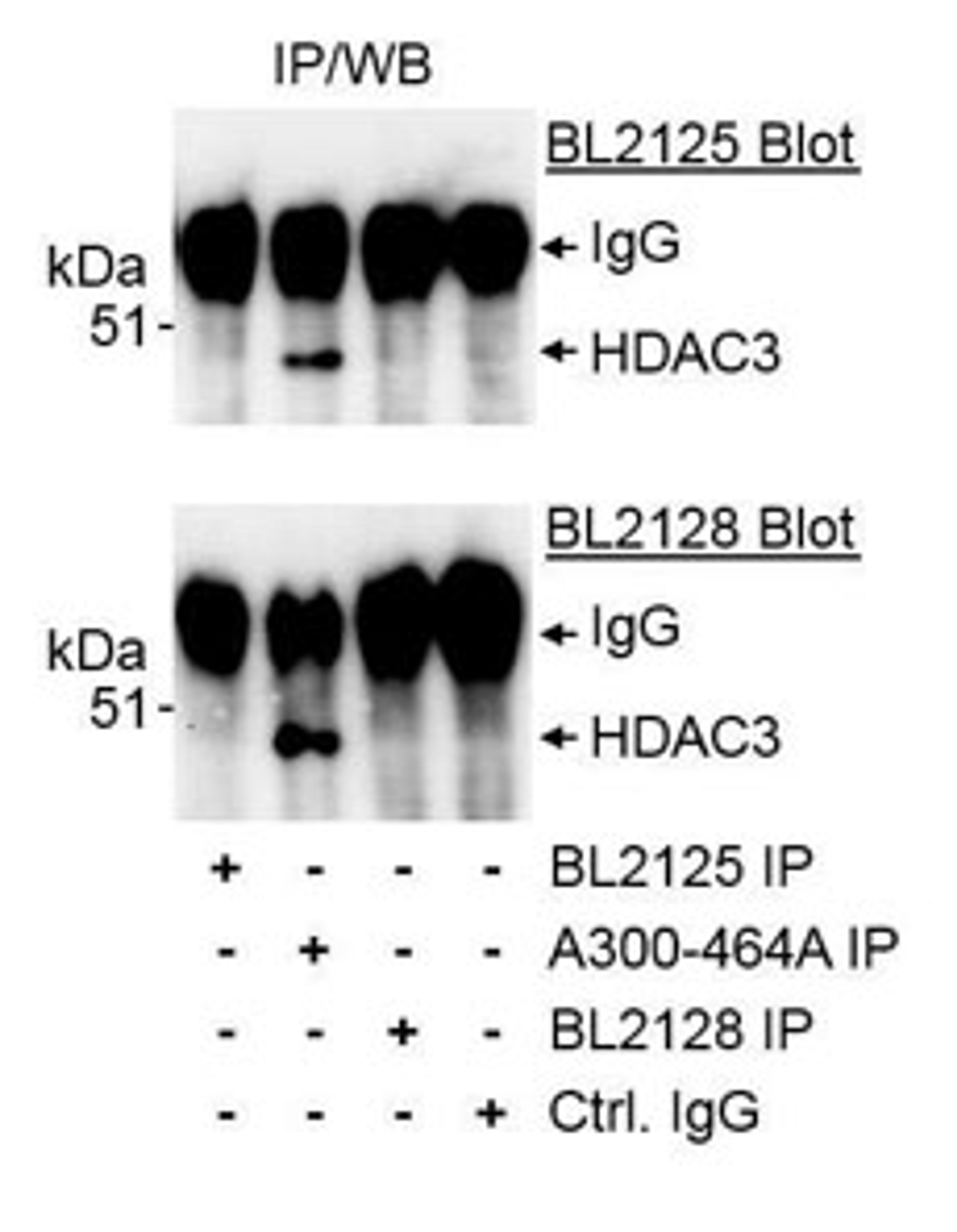 Detection of human HDAC3 by western blot of immunoprecipitates.