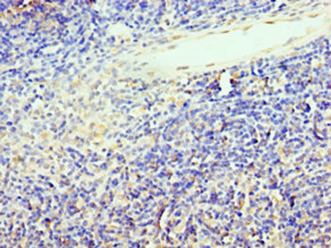 Immunohistochemistry of paraffin-embedded human thymus tissue using CSB-PA023293ESR1HU at dilution of 1:100