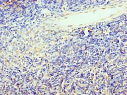Immunohistochemistry of paraffin-embedded human thymus tissue using CSB-PA023293ESR1HU at dilution of 1:100
