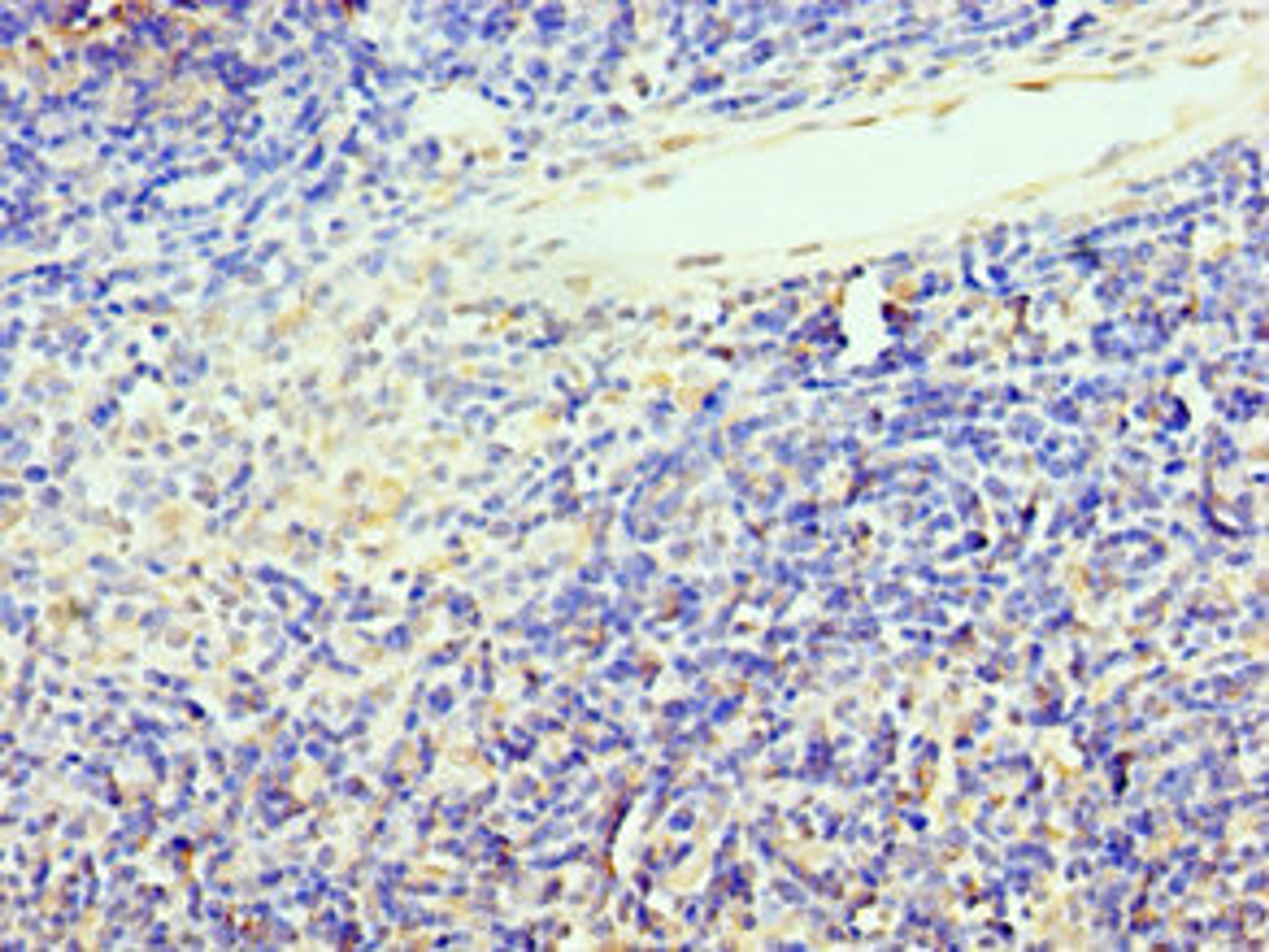 Immunohistochemistry of paraffin-embedded human thymus tissue using CSB-PA023293ESR1HU at dilution of 1:100