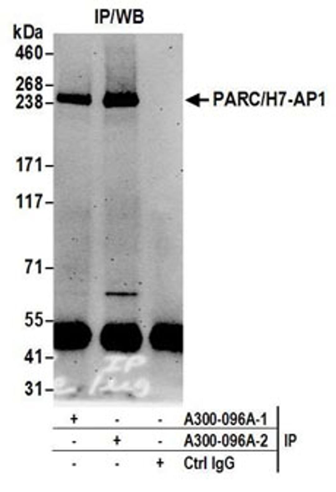 Detection of human PARC/H7-AP1 by western blot of immunoprecipitates.