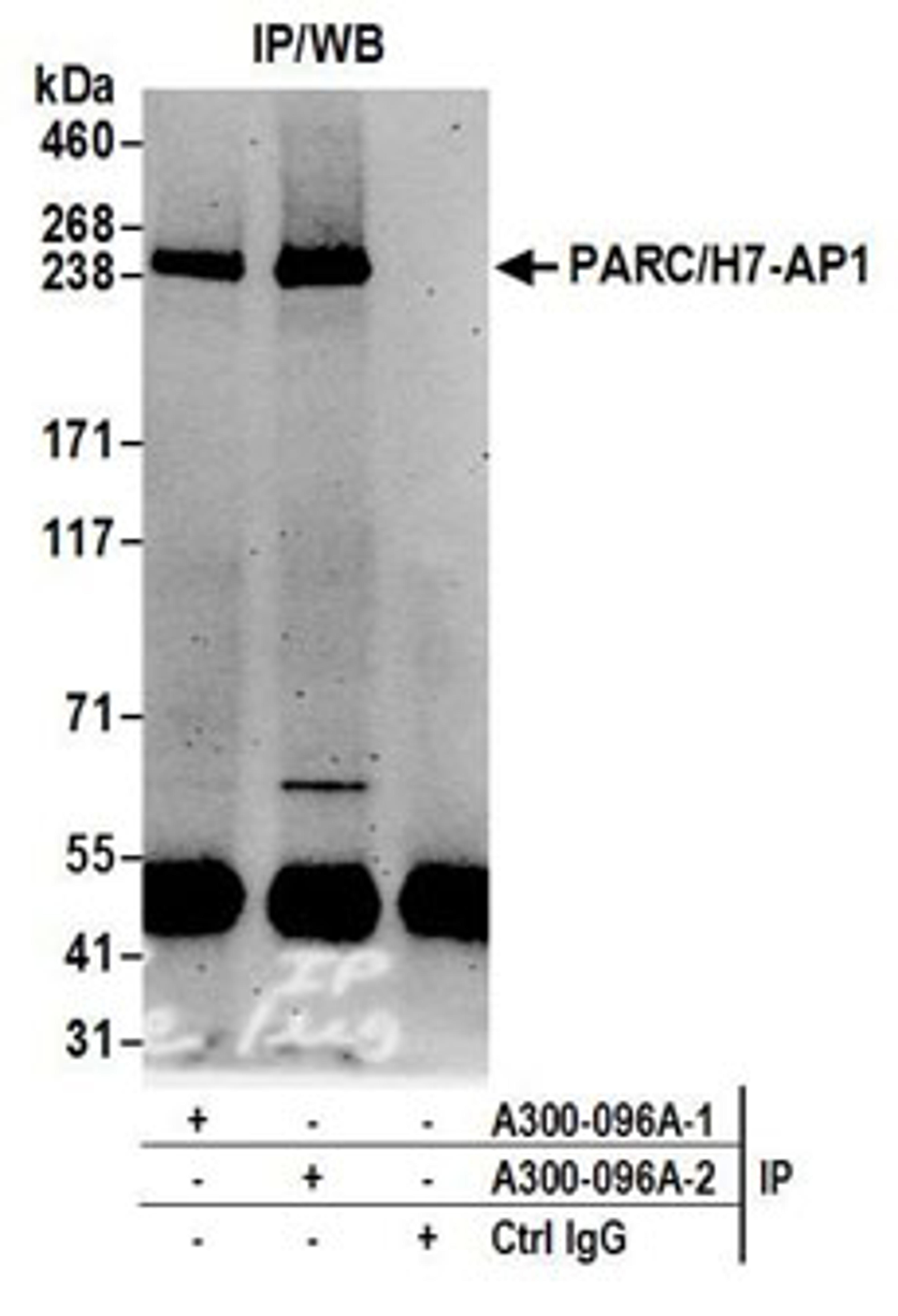 Detection of human PARC/H7-AP1 by western blot of immunoprecipitates.