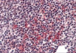 Immunohistochemistry of ZNF687 in human tonsil tissue with ZNF687 antibody at 5 &#956;g/mL.