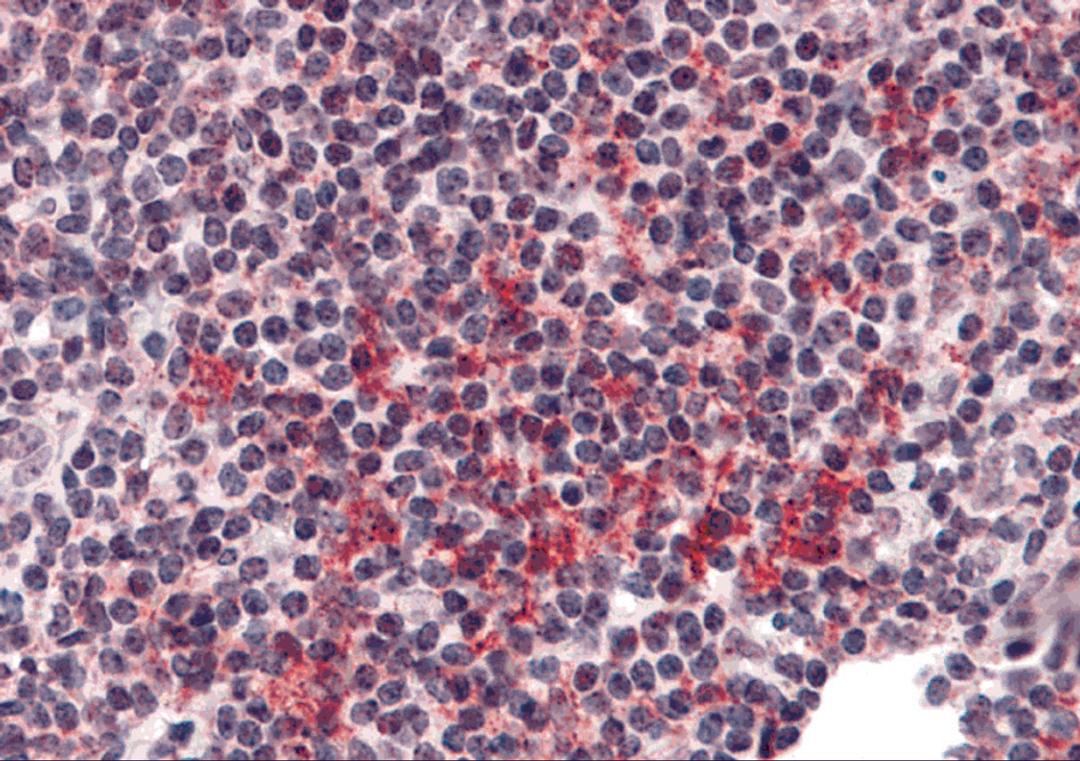 Immunohistochemistry of ZNF687 in human tonsil tissue with ZNF687 antibody at 5 μg/mL.