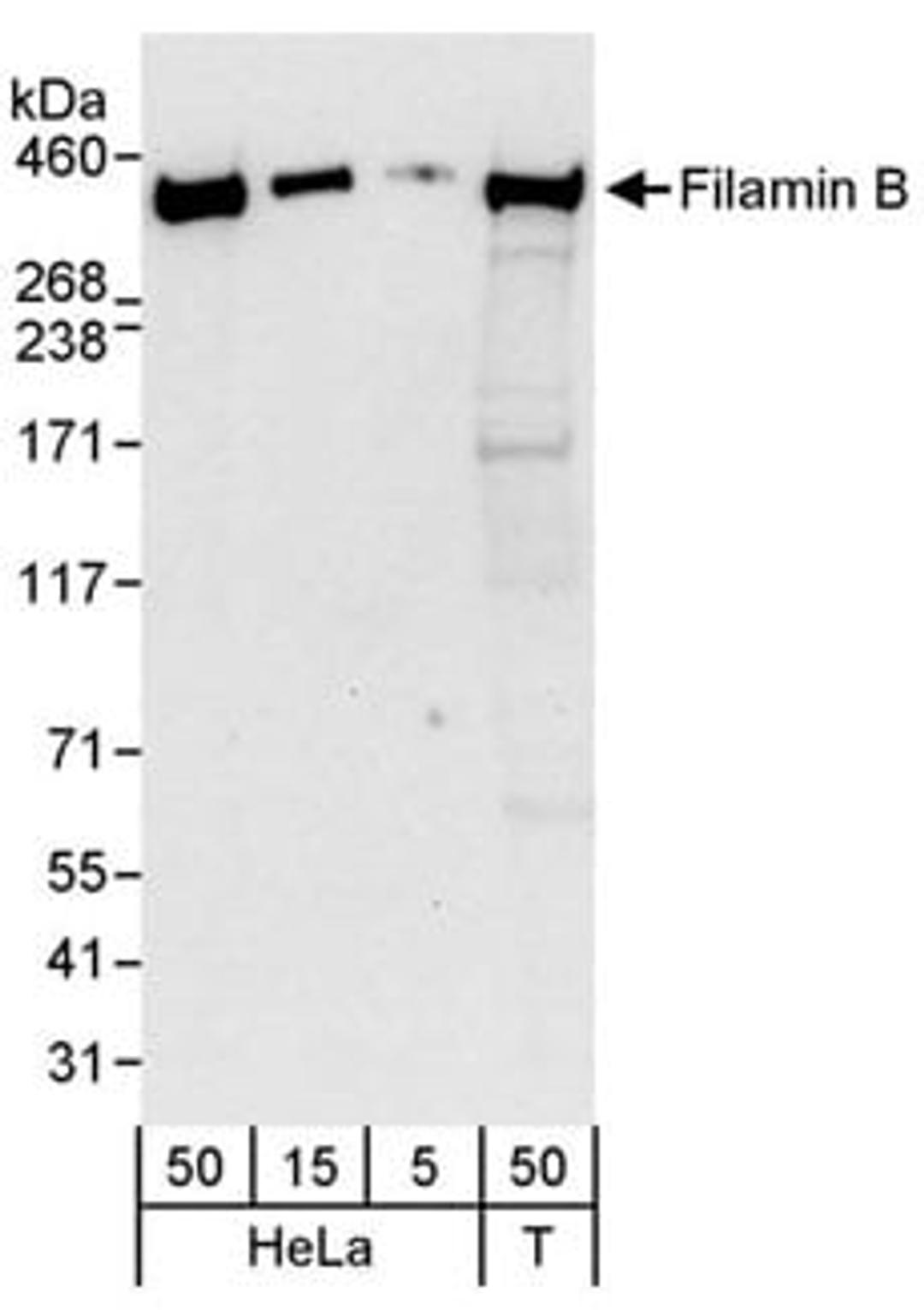 Detection of human Filamin B by western blot.