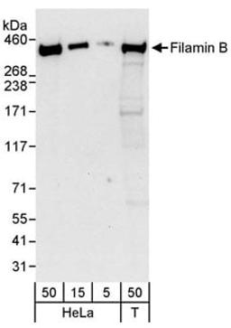 Detection of human Filamin B by western blot.