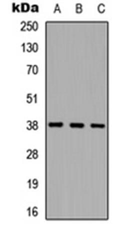 Western blot analysis of HEK293T (Lane 1), NS-1 (Lane 2), PC12 (Lane 3) whole cell lysates using Cathepsin L HC antibody