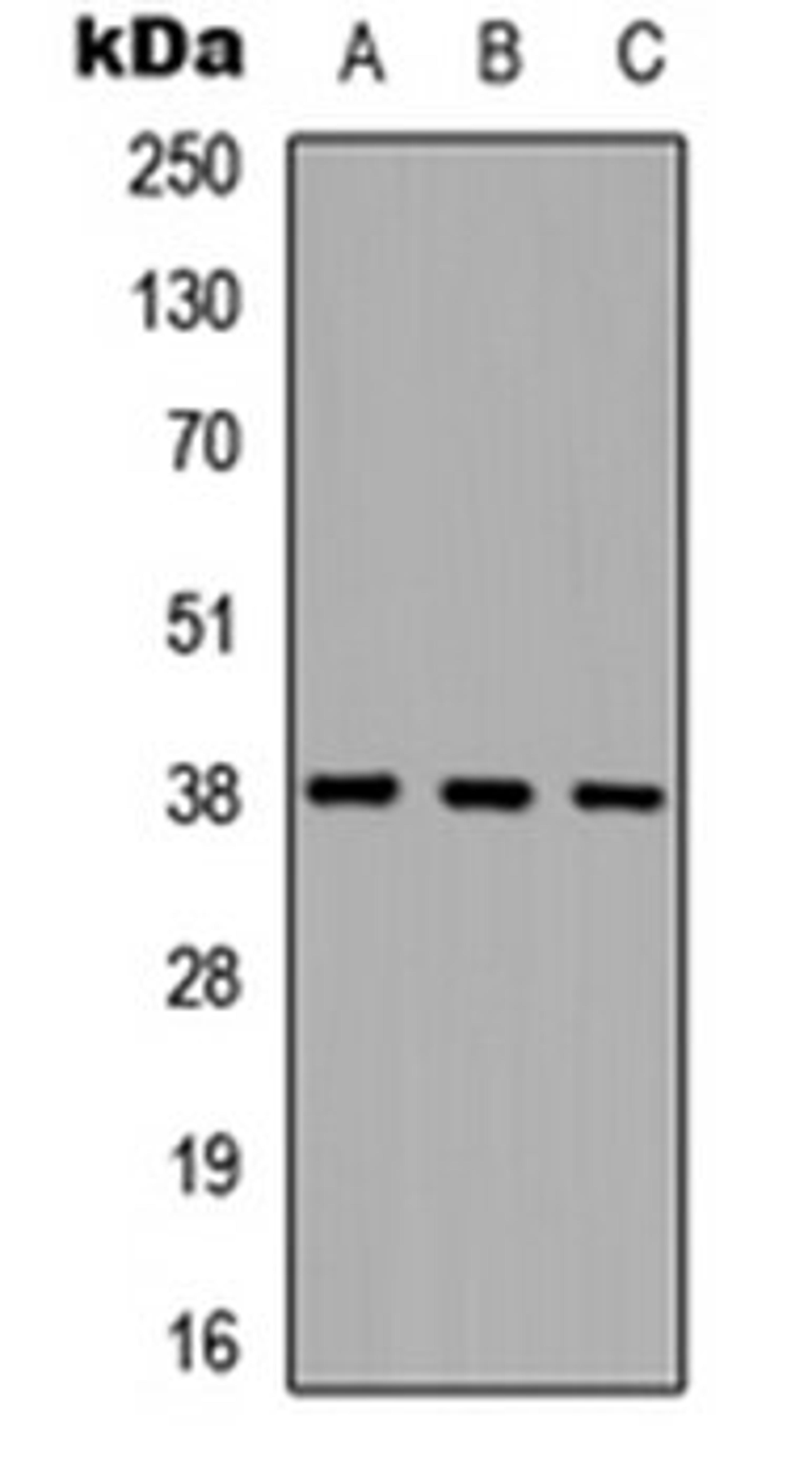 Western blot analysis of HEK293T (Lane 1), NS-1 (Lane 2), PC12 (Lane 3) whole cell lysates using Cathepsin L HC antibody