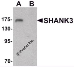 Western blot analysis of SHANK3 in 3T3 cell lysate with SHANK3 antibody at 1 &#956;g/ml in (A) the absence and (B) the presence of blocking peptide.