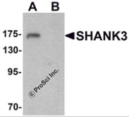 Western blot analysis of SHANK3 in 3T3 cell lysate with SHANK3 antibody at 1 μg/ml in (A) the absence and (B) the presence of blocking peptide.